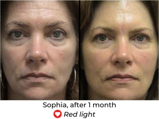 currentbody skin led light therapy face mask before and after