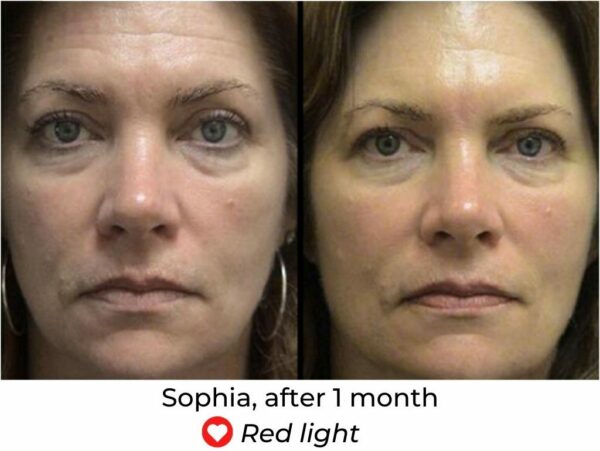blue light face mask before and after