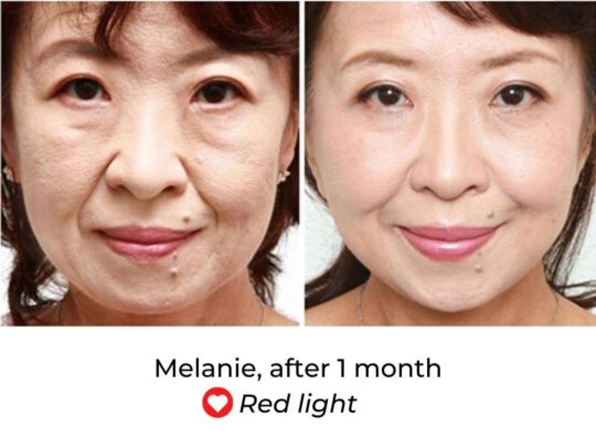 solas led face mask review before and after